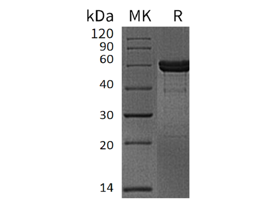 Recombinant Human MMP-3 (C-6His)