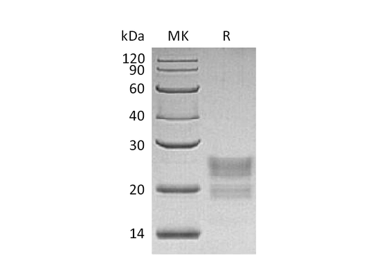 Recombinant Human MPZL1 (C-6His)