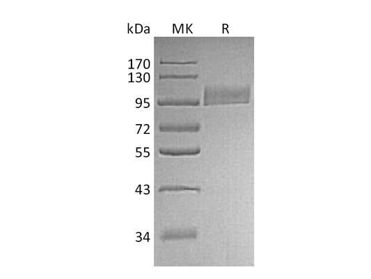 Recombinant Human Neprilysin (N-8His)