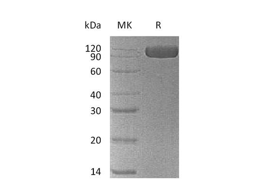 Recombinant Human NCAM-1 (C-6His)