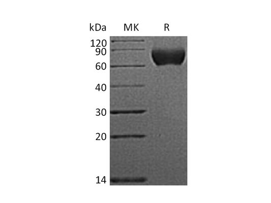 Recombinant Human NgR (C-6His)