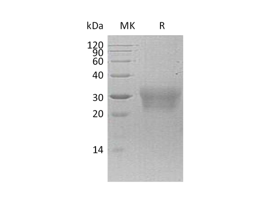 Recombinant Human NPDC1 (C-6His)