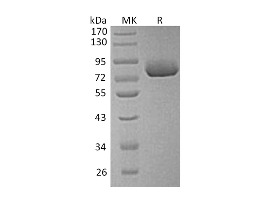 Recombinant Human SPP1 (C-6His)