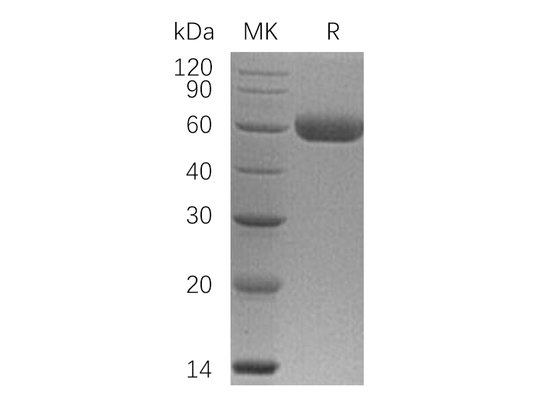 Recombinant Human OPG (C-6His)