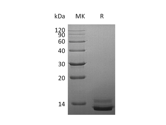 Recombinant Human PPY (C-6His)