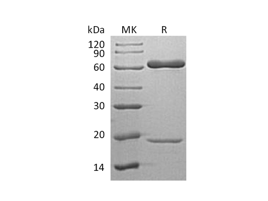 Recombinant Human PCSK9 (C-6His)