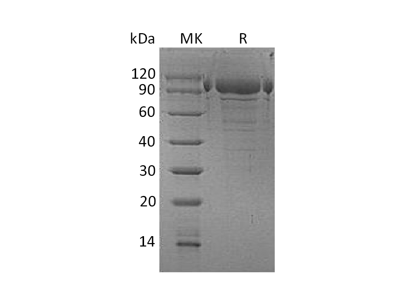 Recombinant Human PDILT (C-6His)