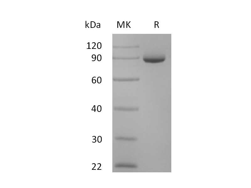Recombinant Human Periostin (C-6His)