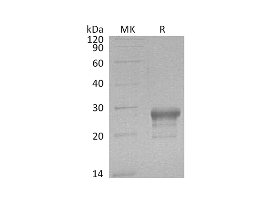 Recombinant Human PTGDS (C-6His)