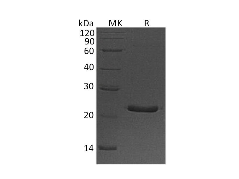 Recombinant Human CSH1 (C-6His)