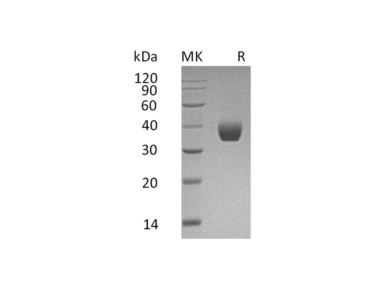 Recombinant Human PPT1 (C-6His)
