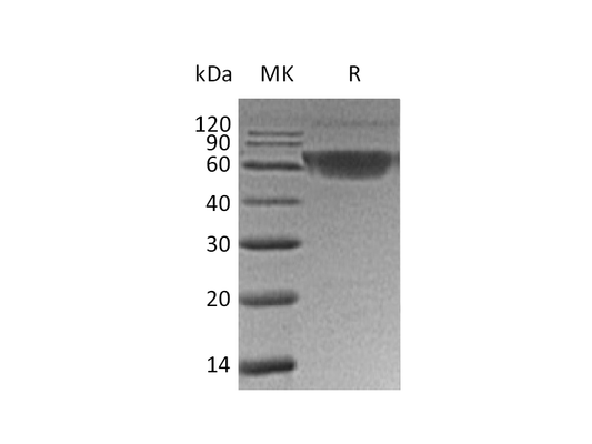 Recombinant Human PD-1 (C-mFc)