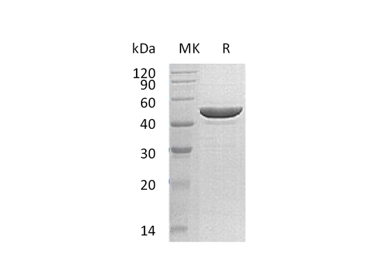 Recombinant Human RRM2 (C-6His)