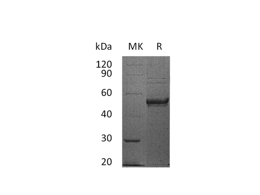 Recombinant Human HVEM (C-Fc)