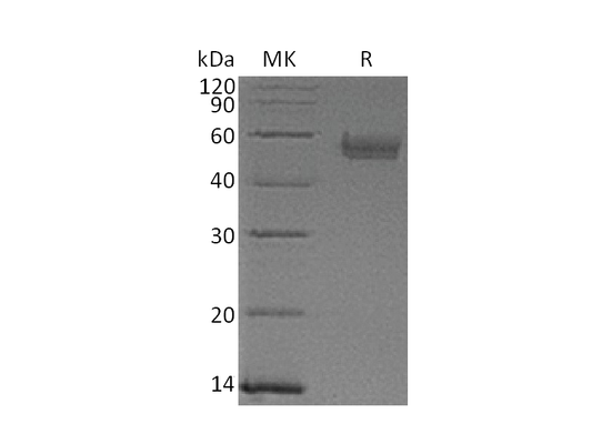 Recombinant Human Serpin A5 (C-6His)