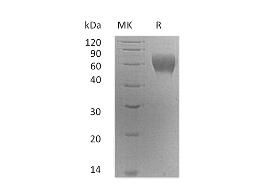 Recombinant Human Serpin A6 (C-6His)