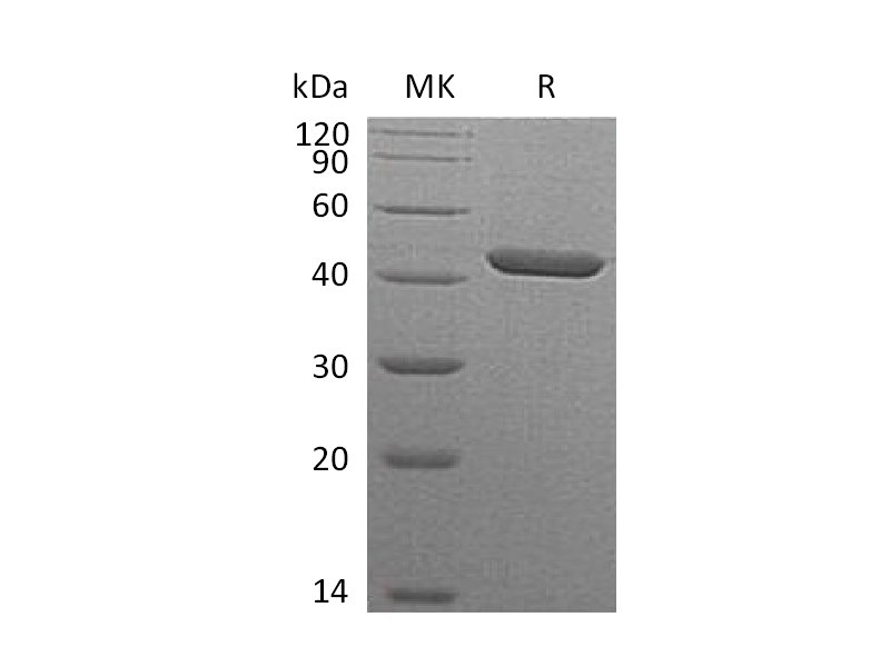 Recombinant Human Serpin B1 (C-6His)