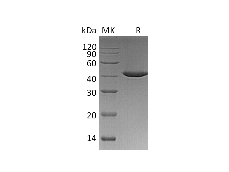 Recombinant Human Serpin B9 (C-6His)