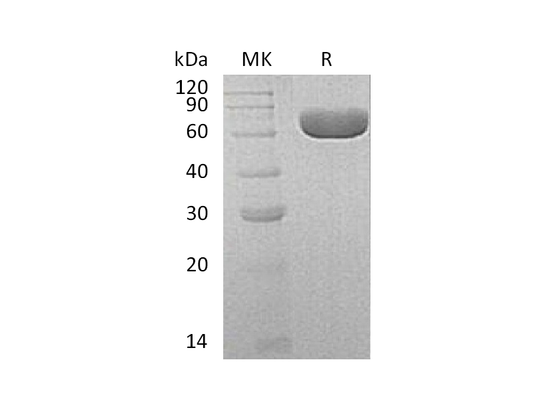 Recombinant Human SIAE (C-6His)