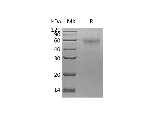 Recombinant Human SPESP1 (C-6His)