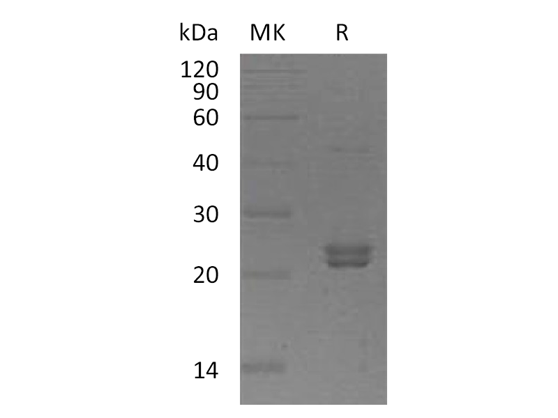 Recombinant Human ST6GalNAc2 (C-6His)