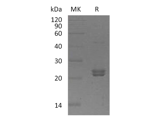 Recombinant Human ST6GalNAc2 (C-6His)