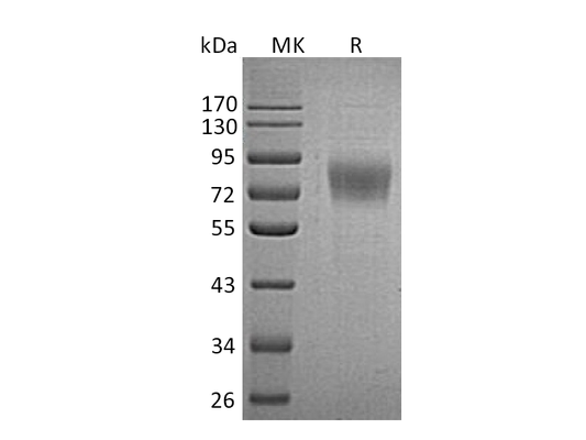 Recombinant Human PLXDC1 (C-6His)