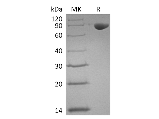 Recombinant Human TFRC (N-6His)
