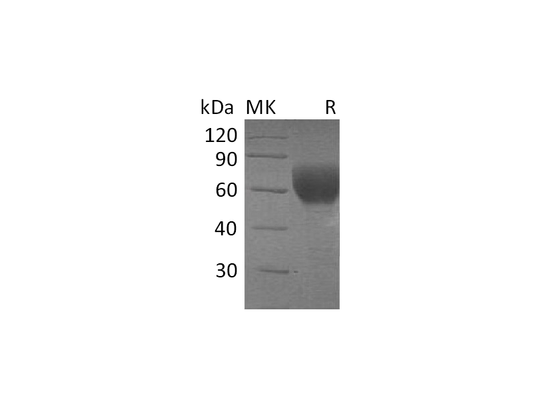 Recombinant Human TGFBR2 (C-Fc)