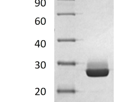Recombinant Human DTYMK (C-6His)