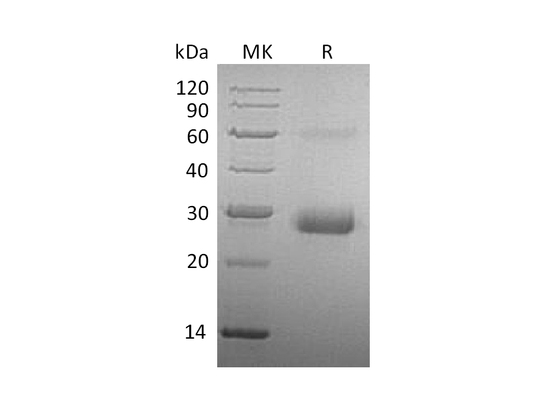Recombinant Human TIMP-1 (C-6His)