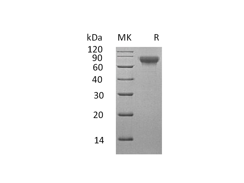 Recombinant Human SLAMF3 (C-6His)