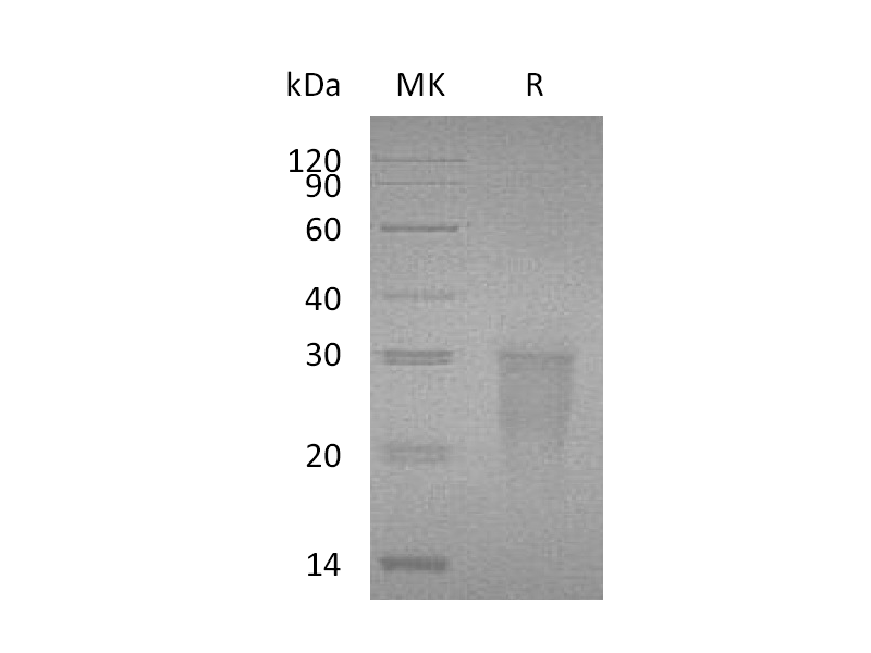 Recombinant Human TMIGD2 (C-6His)