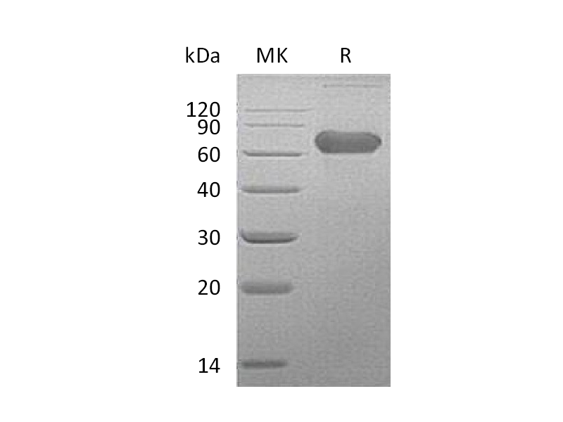 Recombinant Human LTBR (C-Fc)