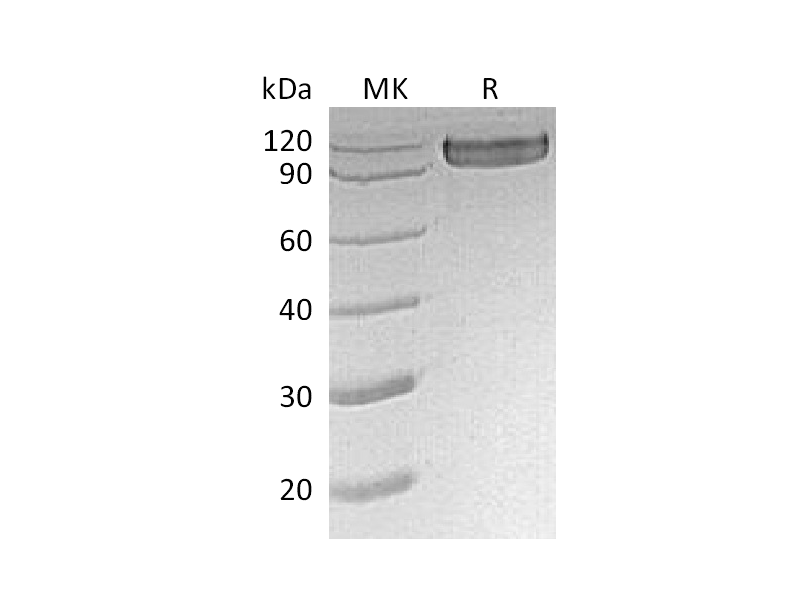 Recombinant Human CD30 (C-Fc)