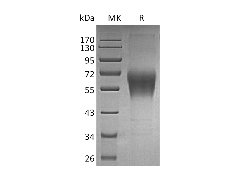 Recombinant Human TRAIL R4 (C-Fc)