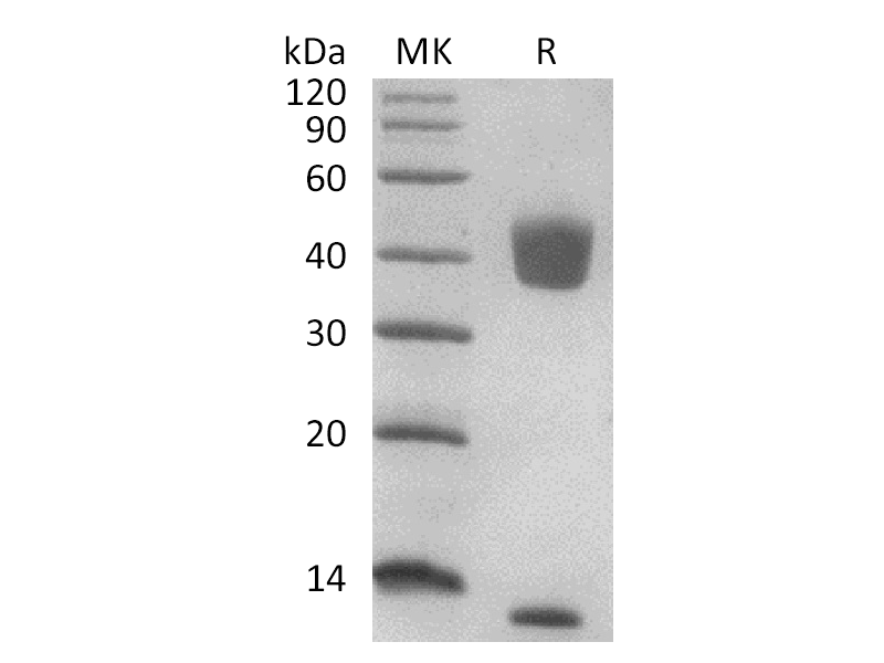 Recombinant Human Latent TGF Beta-1 (N-6His)