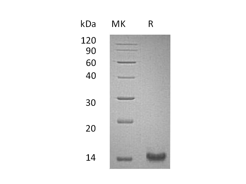 Recombinant Human TFF1 (C-6His)