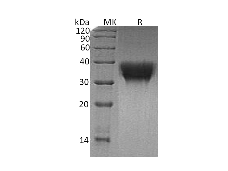 Recombinant Human TREM-1 (C-6His)