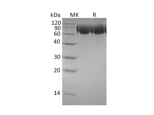 Recombinant Human TrkB (C-6His)