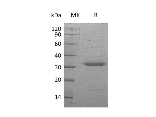 Recombinant Human BSSP-4 (C-6His)