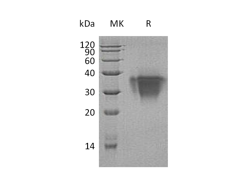 Recombinant Human TWSG1 (C-6His)