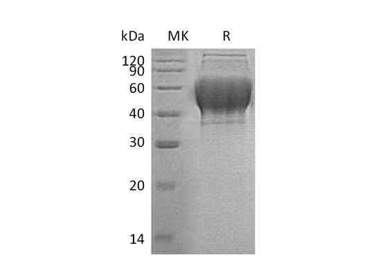 Recombinant Human TXNDC15 (C-6His)