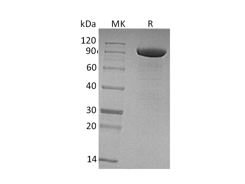 Recombinant Human Tie-1 (C-6His)