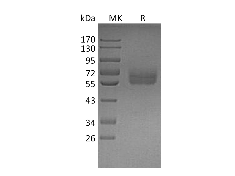 Recombinant Human Dtk (C-6His)