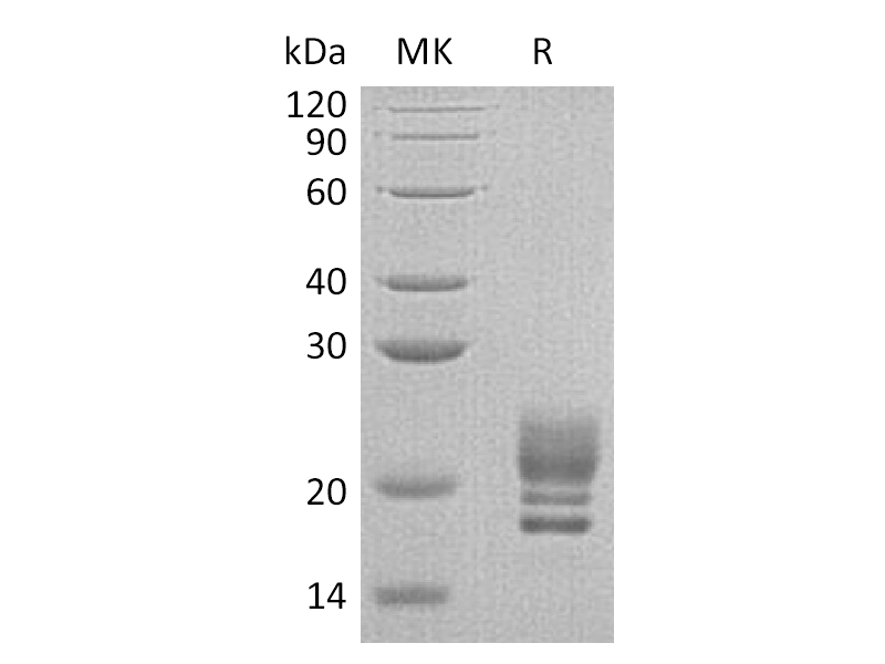Recombinant Human COQ7 (C-6His)