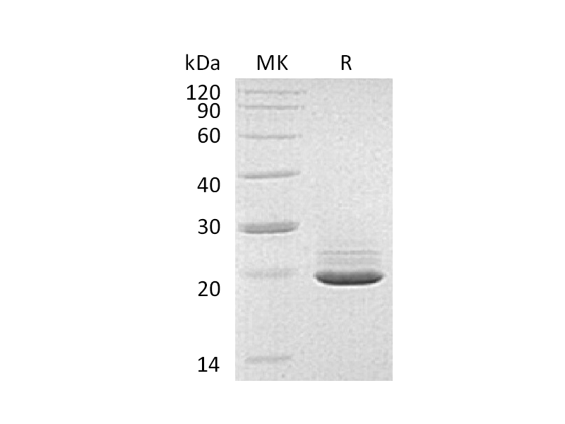 Recombinant Human PRAP1 (C-6His)