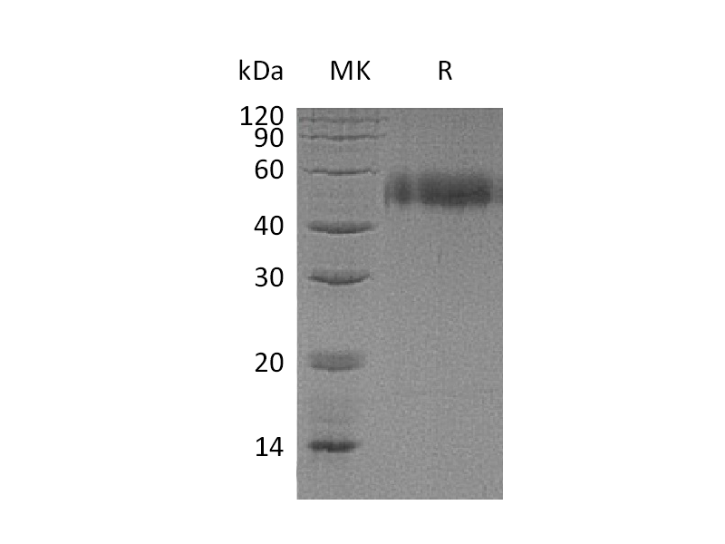 Recombinant Human uPAR (C-6His)