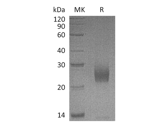 Recombinant Human UPK2 (C-6His)