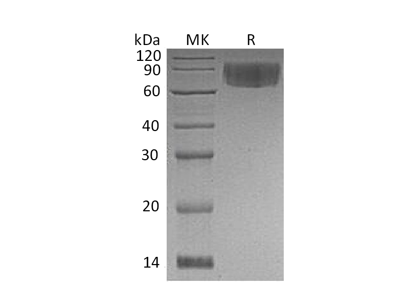Recombinant Human VNN1 (C-6His)
